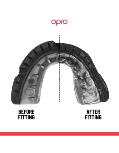 "OPRO" dantų apsauga turintiems breketus Self-Fit UFC Gold Braces - Black/Silver
