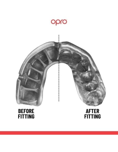 "OPRO" dantų apsauga Self-Fit Gold (adult)