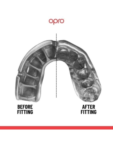 "OPRO" dantų apsauga Self-Fit Gold (adult)