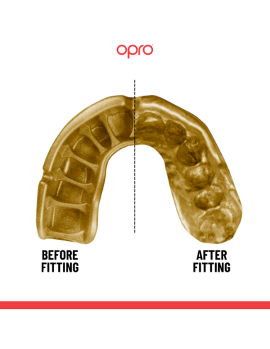"OPRO" dantų apsauga Self-Fit Gold (adult)