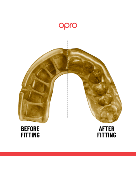 "OPRO" dantų apsauga Self-Fit Gold (adult)