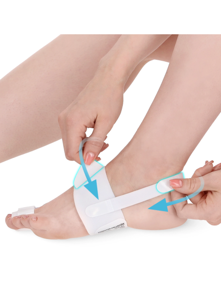 Corrective device for bunion deformity