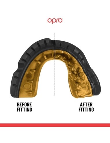 Dantų apsauga OPRO GOLD BRACES ADULT 10+ (juoda)
