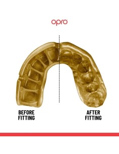 "OPRO" dantų apsauga Self-Fit Gold - Black/Gold 2