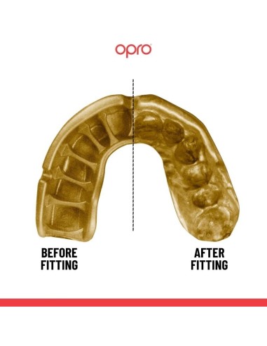 "OPRO" dantų apsauga Self-Fit Gold - Black/Gold