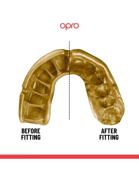 "OPRO" dantų apsauga Self-Fit Gold - Black/Gold